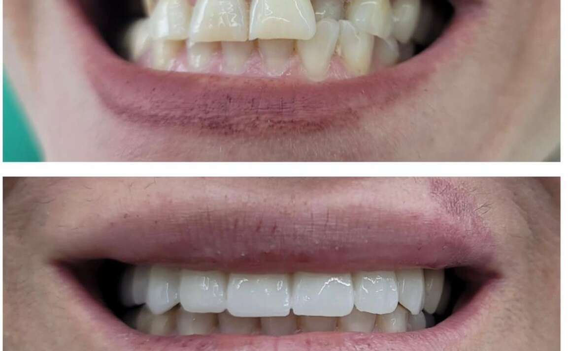 Teaching Your Children to Brush and Floss