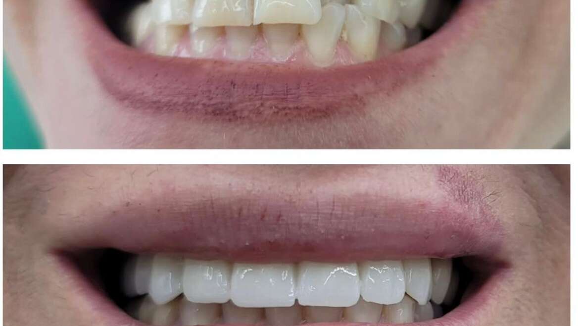 Teaching Your Children to Brush and Floss