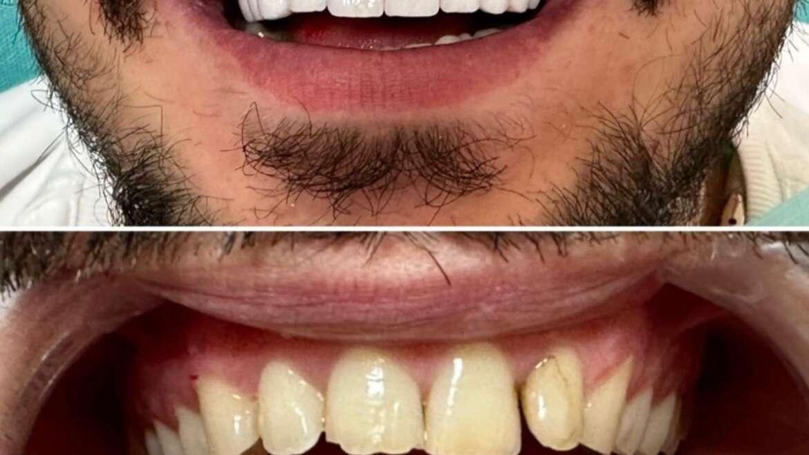 We Eliminate the Inconvenience of Multiple Visits