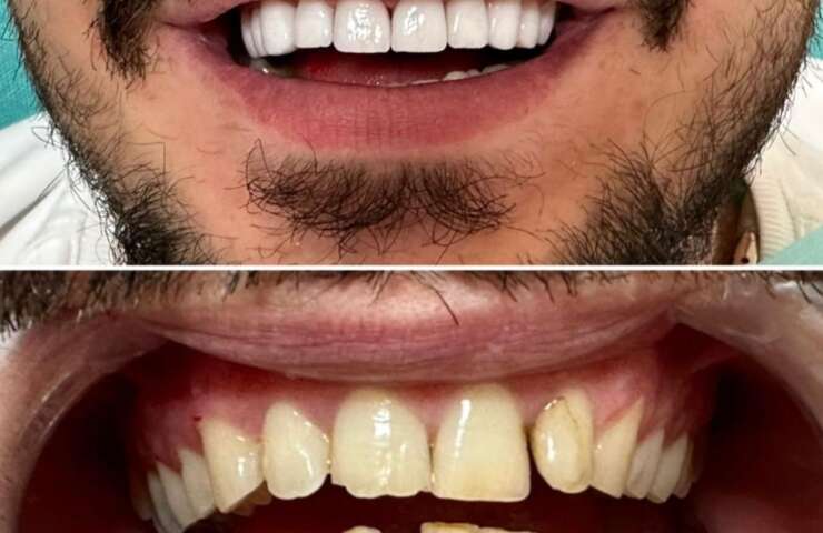 We Eliminate the Inconvenience of Multiple Visits