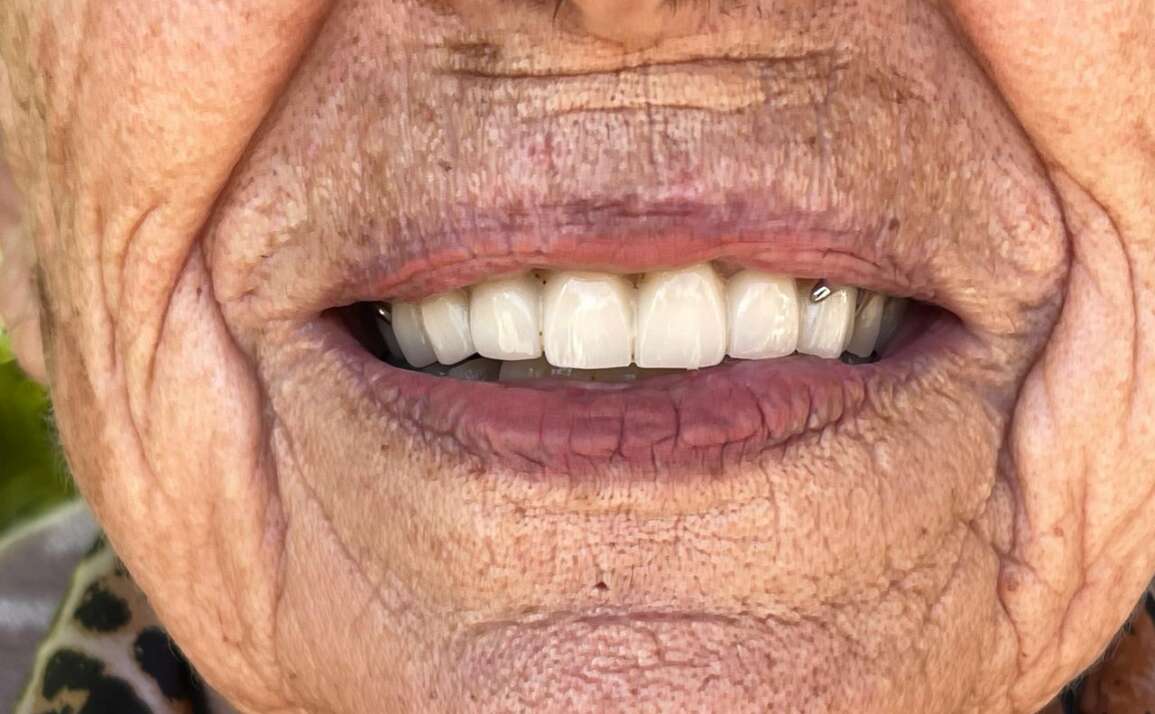 The Evolution of Dentistry: What is trending now and what will the future hold?