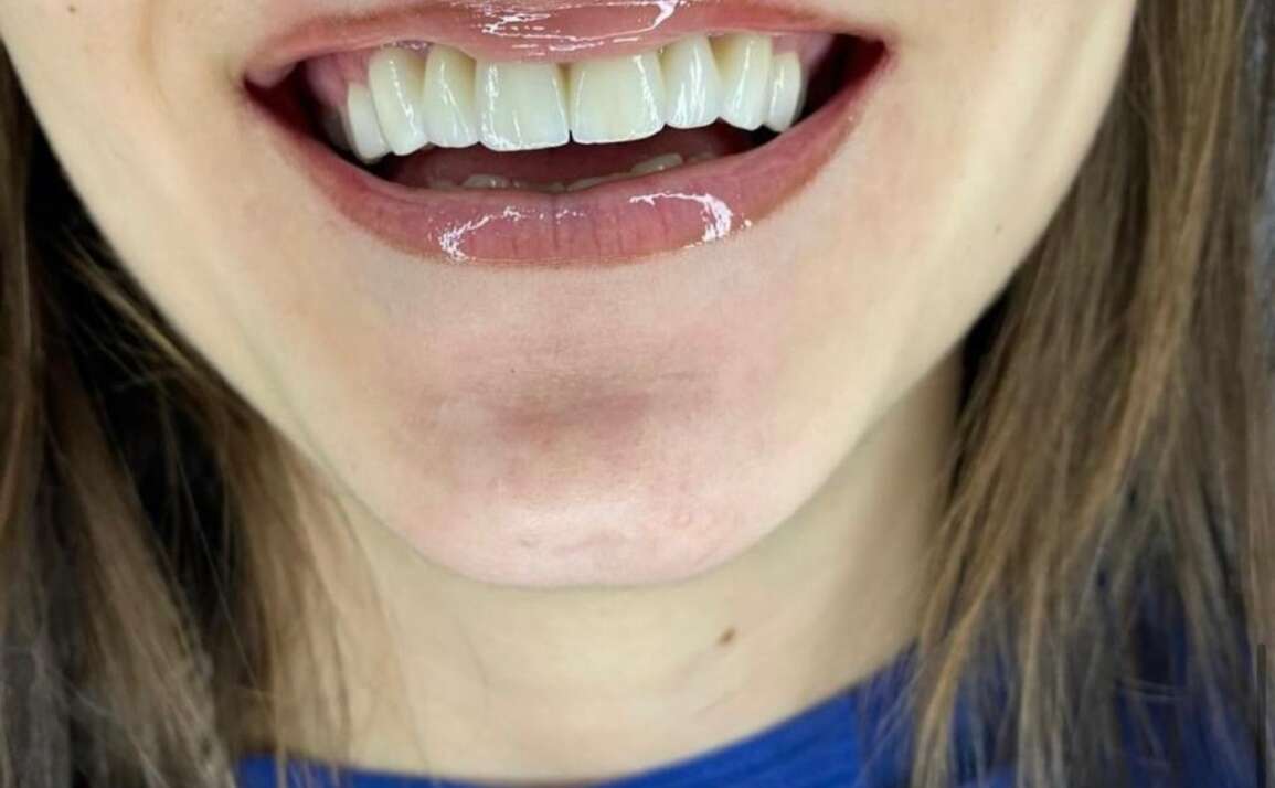 Beyond tooth decay: why good dental hygiene is important