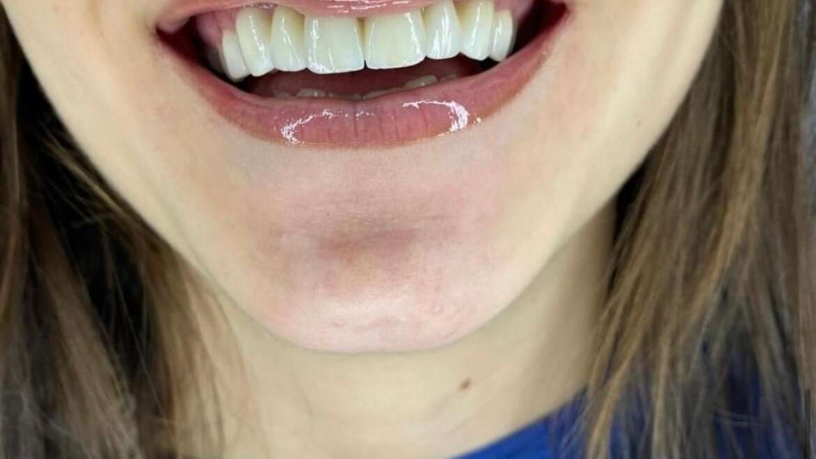 Beyond tooth decay: why good dental hygiene is important