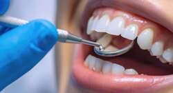 Cómo mantener una dentadura sana a diario